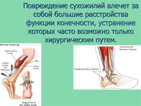 Швы сухожилий - презентация онлайн