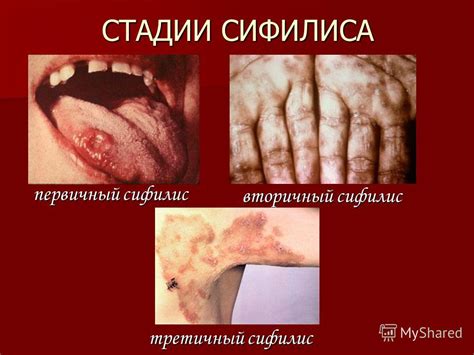 Презентация на тему: "Венерические заболевания – это болезни ...