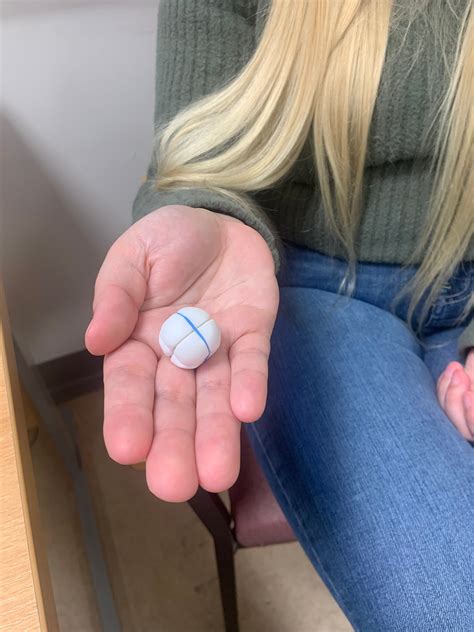 First patients in UK receive revolutionary device to stop acid reflux