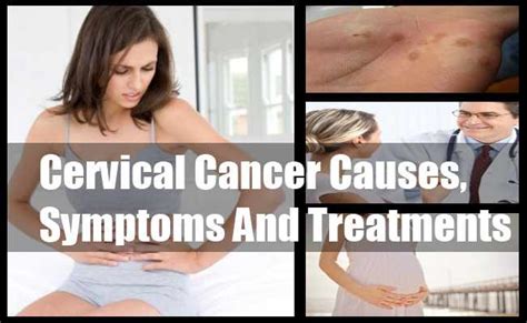 8 symptoms of cervical cancer