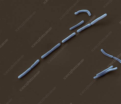 bacillus pumilus sem stock image  science photo library