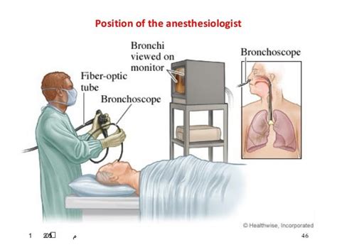 Fiberoptic intubation