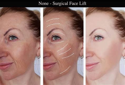 surgical face lift headington nhs dental practice oxford cowley