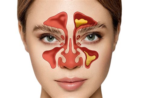 Simple Ways to Clear Nasal Congestion and Why It Matters - Optimal ...