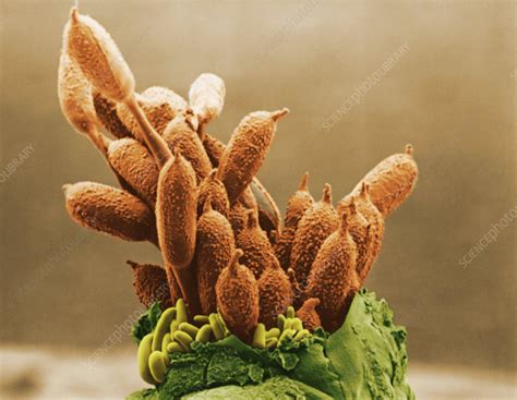 Rose Rust - Stock Image - C025/2955 - Science Photo Library