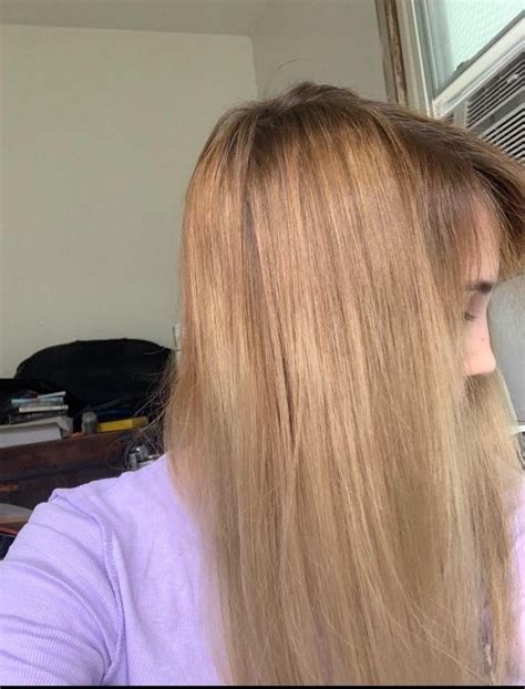 normal hair growth   pic   pic  rhair