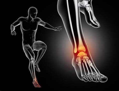 Ankle Injury and Disorders : What precautions we need to take