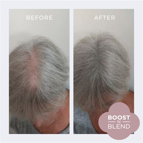 Does Weight Loss Cause Hair Loss? - Female Hair Loss Help