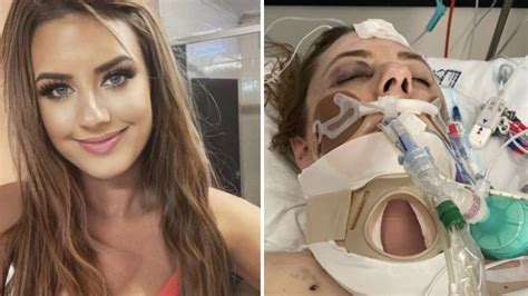 Heartbreaking update from rollercoaster accident two years on | OverSixty