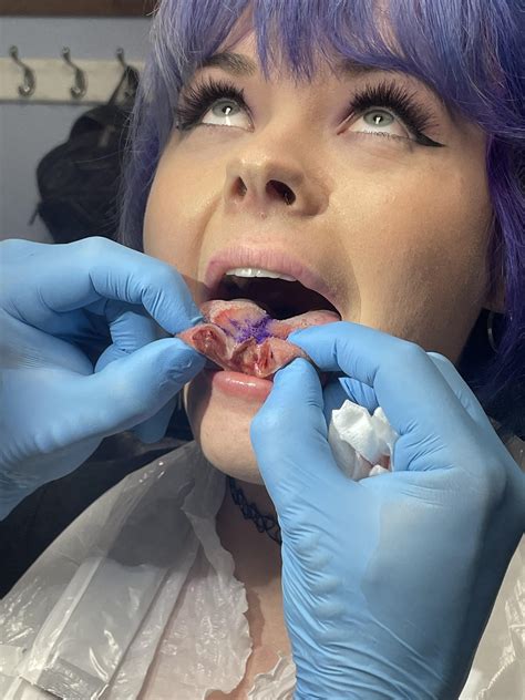 Freshly split tongue : r/bodymods