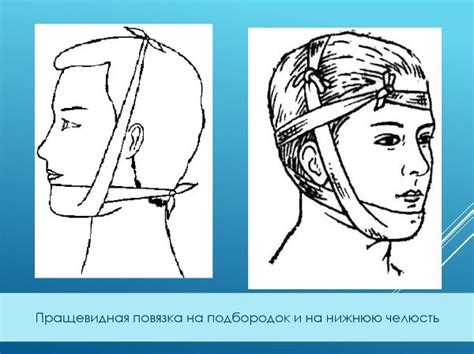 Эффективность подбородочной пращи при коррекции мезиальнго прикуса