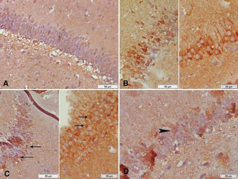 Photomicrograph of hippocampus area sections stained... | Download ... 