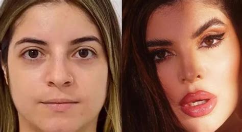 Antes E Depois Da Gkay - GKay Antes e Depois 2023 - confira os procedimentos que ela fez!