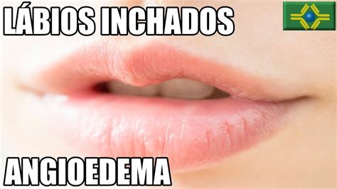 Labios Inchado E Dormente