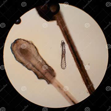 Demodex Folliculorum - Parasitic Mite on the Eyelashes of a Human Eye ...