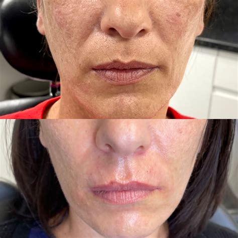 Public health experts are discussing antonia novello impact on policy 4