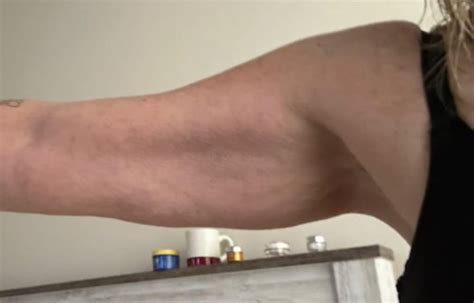 arm firming cream fountain