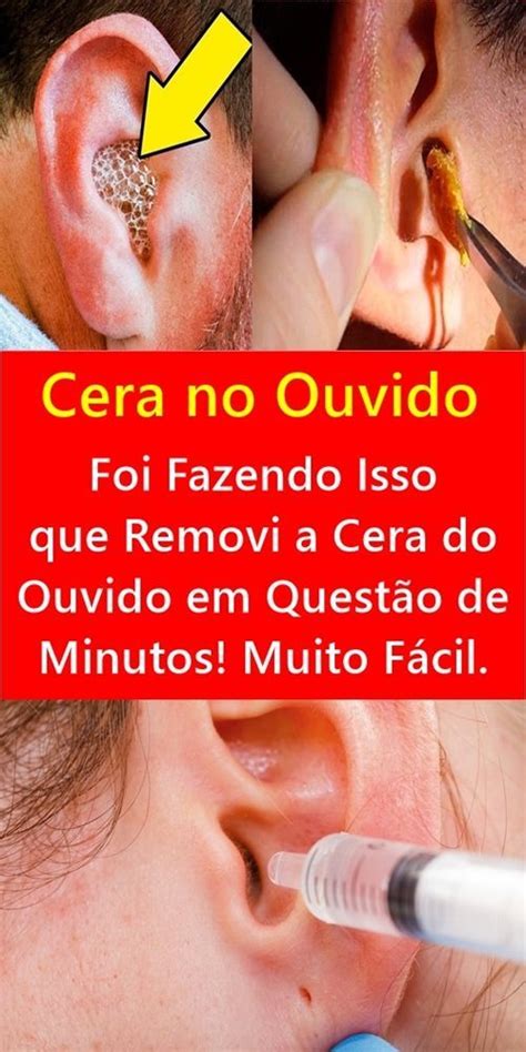 Como Amolecer A Cera Do Ouvido
