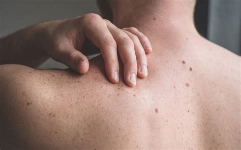 skin bumps  lumps     scripps health
