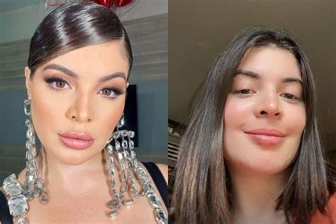Antes E Depois Gkay
