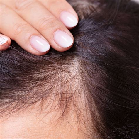 Growth Factor Concentrate (GFC) - Uks Derma