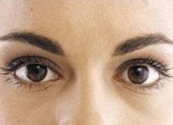 eye surgery types eye surgery