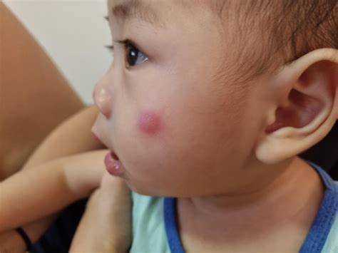 Pet owners are clashing over causing newborn flea bites at home 12