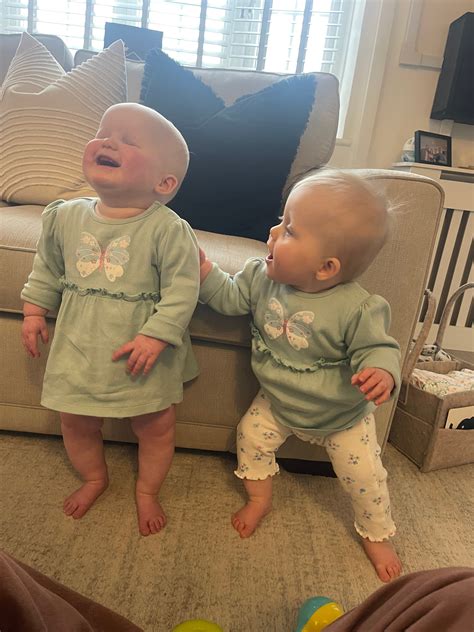 baby born  eyes due  extremely rare condition