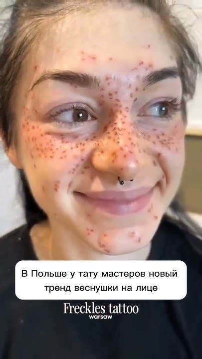 В Польше у тату-мастеров новый тренд — веснушки на лице. #новости #news ...
