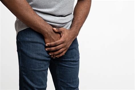 Phimosis | Urologie Steinberg