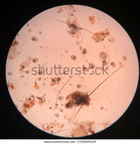 Closed Sarcoptic Mange Microscope Stock Photo (Edit Now) 1330009634