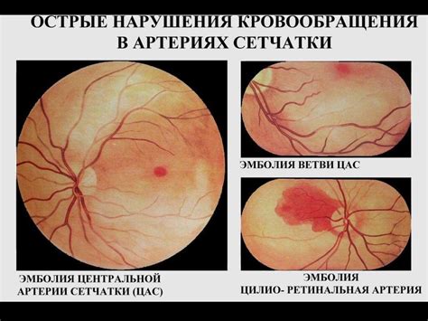Изменение органа зрения при общих заболеваниях - презентация онлайн