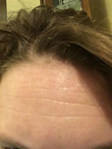 big forehead funny pics 3