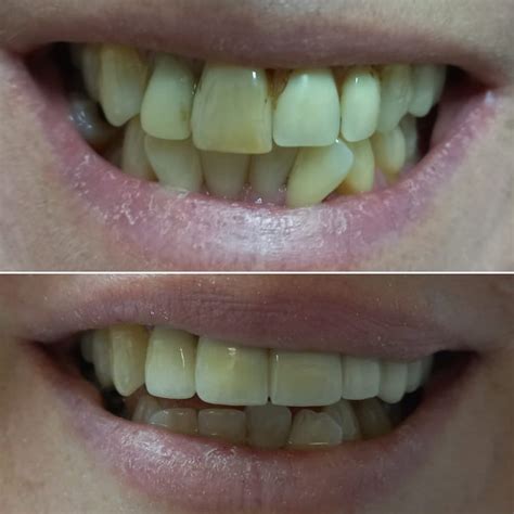 dr stefan bekker oudtshoorn