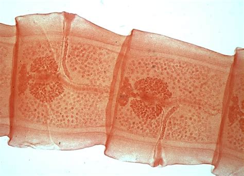 mature fish tapeworm  donita humphrey blog