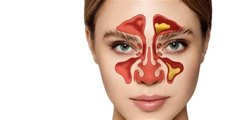 Nasal and Sinus Surgery for Chronic Sinusitis Relief