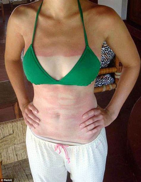 Are these the WORST sun tan fails ever? | Daily Mail Online