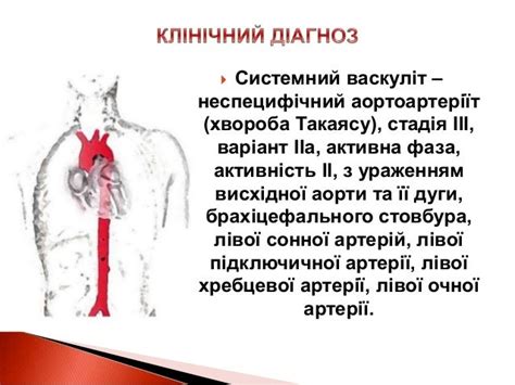 Клинический случай поздней диагностики болезни Такаясу