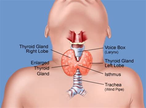 Thyroid Disease: Types, Symptoms, Causes, and Treatment