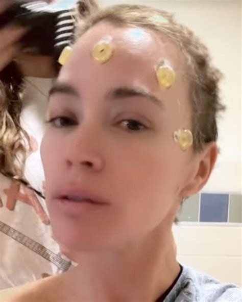 Teddi Mellencamp Undergoes Emergency Brain Tumor Surgery—Just Months