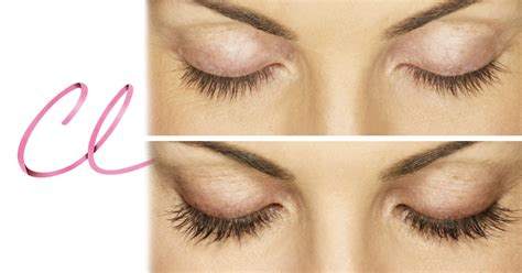 Latisse Cílios Antes E Depois - Latisse Antes E Depois Dos Homens