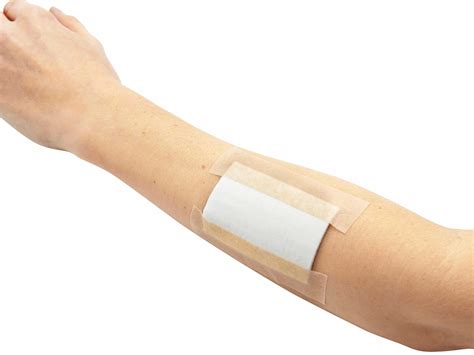 sterile compresses xl salvequick