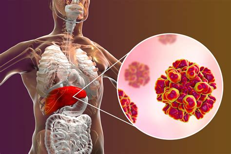 Investigators Discover How Hepatitis E Virus Infiltrates Cells