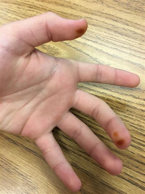 These little dots just appeared overnight no sign of them beforehand