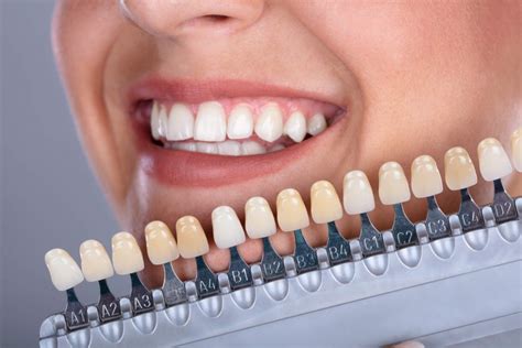 Cor De Dente A1 E B1 - Cor De Dente A1 E B1 - RETOEDU