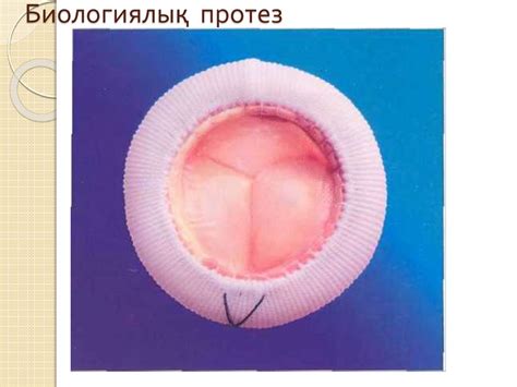 Жүрек кемістіктері - презентация онлайн