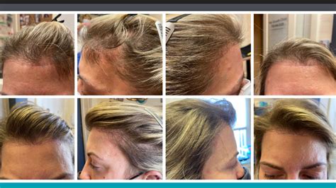 how often to get hair trimmed for growth