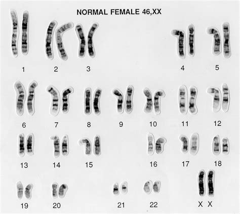 Normal female 46,XX human karyotype | Wellcome Collection