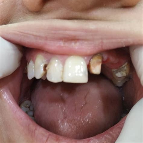 Стоматологическая Клиника "Dentalux" - Home | Facebook