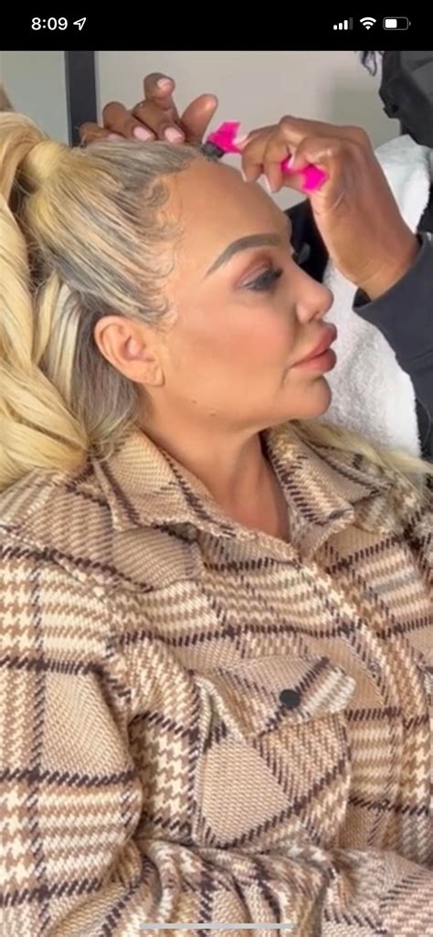 This makes my butt hurt just looking at it : r/Botchedsurgeries